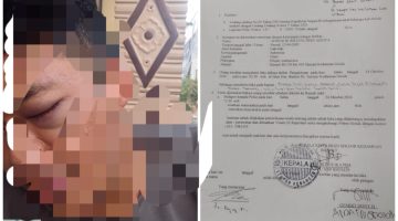 DIDUGA Dikeroyok Tiga Pemuda di Buton, Warga Slempit Gresik Tersungkur dan Alami Pemukulan Berulang